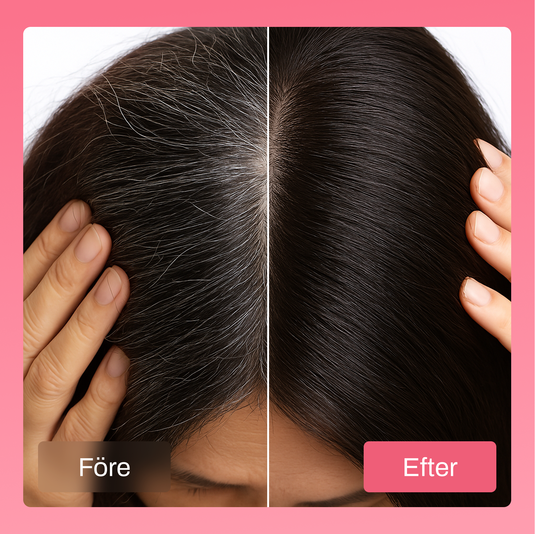 HairFiller